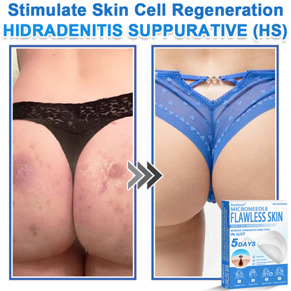 📌 Awzlove® 2-in-1 Microneedle & Hydrocolloid Patch | Raised Moles,Acne,  Flat Warts & Skin Tags Remover | Improves Wrinkles, Scars & Blemishes | Invisible Star Pimple Patches for Face & Body |🎁🎁