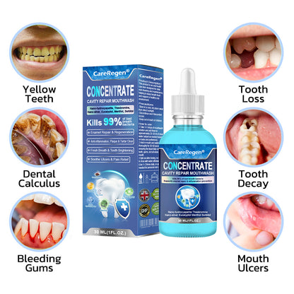Official Store：🏆CareRegen® CONCENTRATE REPAIR MOUTHWASH(Dentist recommended)(Flying Off the Shelves: 100,000 Bottles Sold!)🎀