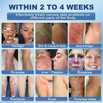 Official Store |Awzlove® GHK-Cu · NAD+ Peptide · EGT 10-in-1 Bio-Hacking Ultimate Ampoule | for Cellular Repair & Skin Longevity,From Acne & Redness to Deep Wrinkles & Laxity (Visible Results in 7 Days)