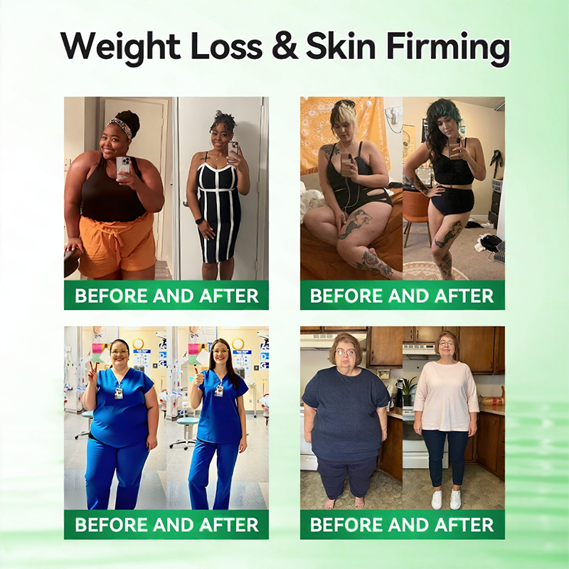 𝑶𝒇𝒇𝒊𝒄𝒊𝒂𝒍 𝑺𝒕𝒐𝒓𝒆  | 👨‍⚕️Healrize®𝑴𝒐𝒓𝒊𝒏𝒈𝗮 · 𝗕𝗲𝗿𝗯𝗲𝗿𝙞𝙣𝙚 × 𝙉𝘼𝐃+ 𝟏𝟎-𝐢𝐧-𝟏 𝗔𝗱𝘃𝗮𝗻𝗰𝙚𝙙 Nano Microwave Thermal Metabolic Patch(𝐉𝐮𝐬𝐭 𝐨𝐧𝐜𝐞 𝐚 𝐝𝐚𝐲, 𝐯𝐢𝐬𝐢𝐛𝐥𝐞 𝐜𝐡𝐚𝐧𝐠𝐞𝐬 𝐢𝐧 𝟕 𝐝𝐚𝐲𝐬） ✅ 𝐅𝐨𝐫 𝐨𝐛𝐞𝐬𝐢𝐭𝐲, 🅛🅞🅞🅢🅔 🅢🅚🅘🅝,𝐝𝐢𝐚𝐛𝐞𝐭𝐞𝐬, 𝐬𝐥𝐞𝐞𝐩 𝐚𝐩𝐧𝐞𝐚, 𝐣𝐨𝐢𝐧𝐭 𝐢𝐬𝐬𝐮𝐞𝐬, 𝐚𝐧𝐝 𝐦𝐨𝐫𝐞 🌞
