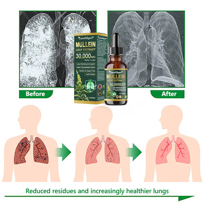 𝗢𝗳𝗳𝗶𝗰𝗶𝗮𝗹 𝗦𝘁𝗼𝗿𝗲:CareRegen®🌹💧 𝗢𝗿𝗴𝗮𝗻𝗶𝗰 𝗟𝘂𝗻𝗴 𝗖𝗹𝗲𝗮𝗻𝘀𝗶𝗻𝗴 𝗠𝘂𝗹𝗹𝗲𝗶𝗻 𝗟𝗲𝗮𝗳 𝗘𝘅𝘁𝗿𝗮𝗰𝘁 𝗗𝗿𝗼𝗽𝘀  𝐂𝐥𝐢𝐧𝐢𝐜𝐚𝐥𝐥𝐲 𝐩𝐫𝐨𝐯𝐞𝐧, 𝐡𝐢𝐠𝐡𝐥𝐲 𝐜𝐨𝐧𝐜𝐞𝐧𝐭𝐫𝐚𝐭𝐞𝐝 𝐟𝐨𝐫𝐦𝐮𝐥𝐚 𝐭𝐡𝐚𝐭 𝐫𝐞𝐥𝐢𝐞𝐯𝐞𝐬 𝐜𝐨𝐮𝐠𝐡, 𝐩𝐡𝐥𝐞𝐠𝐦, 𝐚𝐬𝐭𝐡𝐦𝐚 & 𝐂𝐎𝐏𝐃 — 𝐛𝐫𝐞𝐚𝐭𝐡𝐞 𝐞𝐚𝐬𝐢𝐞𝐫, 𝐟𝐚𝐬𝐭𝐞𝐫. 💨