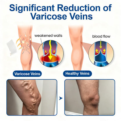 🇬🇧👨‍⚕️👍✅Healrize® VeinTarget Microneedle Patch⚡Instant Relief, Long-Term Results🍉❤️