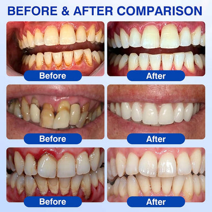Healrize® GumRevive Periodontal Repair Gel (for bleeding gums, receding gums, and loose teeth)🥰☀️