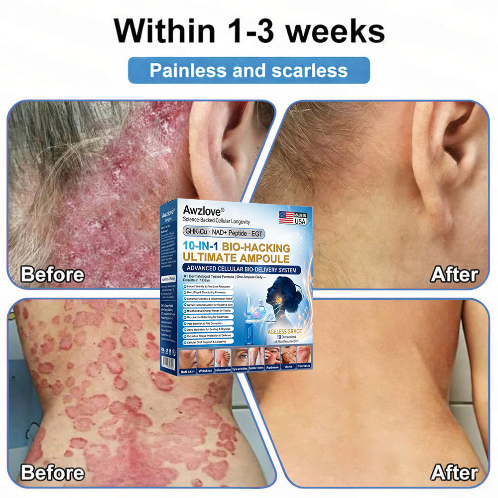 Official Store |Awzlove® GHK-Cu · NAD+ Peptide · EGT 10-in-1 Bio-Hacking Ultimate Ampoule | for Cellular Repair & Skin Longevity,From Acne & Redness to Deep Wrinkles & Laxity (Visible Results in 7 Days)