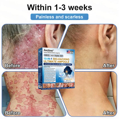 Official Store |Awzlove® GHK-Cu · NAD+ Peptide · EGT 10-in-1 Bio-Hacking Ultimate Ampoule | for Cellular Repair & Skin Longevity,From Acne & Redness to Deep Wrinkles & Laxity (Visible Results in 7 Days)