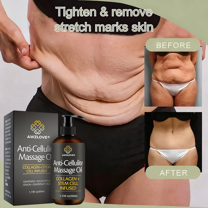 Awzlove® Luxurious Collagen & Stem Cell Anti-Cellulite Massage Oil🎉 (🔥70% Off for a Limited Time!) 💜