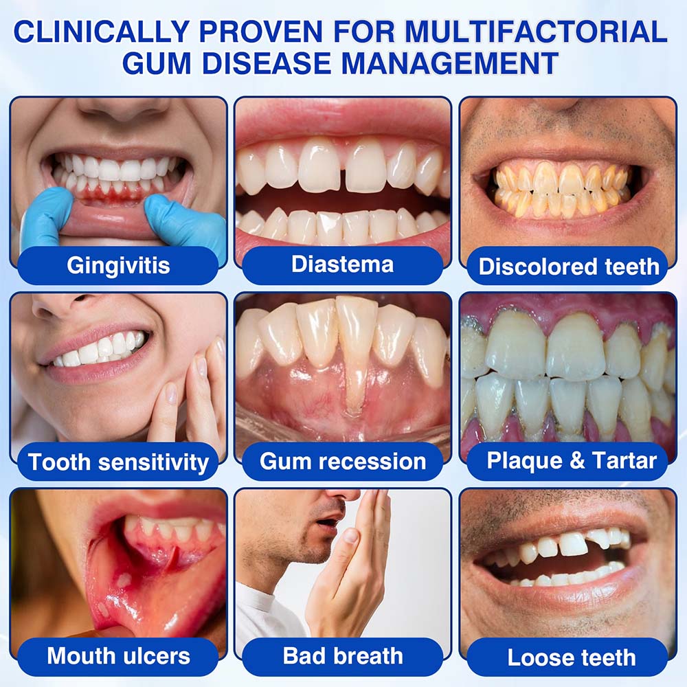 Healrize® GumRevive Periodontal Repair Gel (for bleeding gums, receding gums, and loose teeth)🥰☀️
