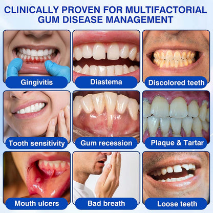 Healrize® GumRevive Periodontal Repair Gel (for bleeding gums, receding gums, and loose teeth)🥰☀️