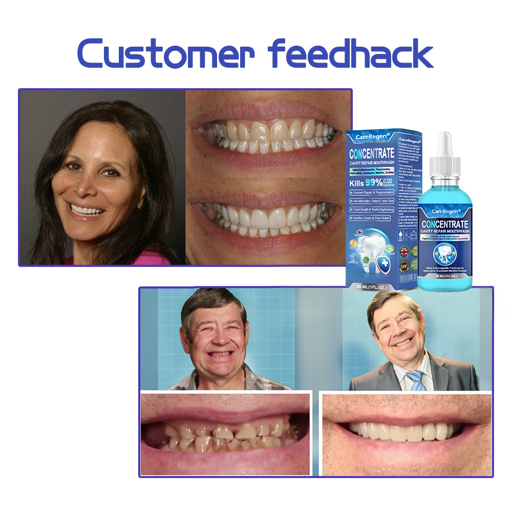 Official Store：🏆CareRegen® CONCENTRATE REPAIR MOUTHWASH(Dentist recommended)(Flying Off the Shelves: 100,000 Bottles Sold!)🎀