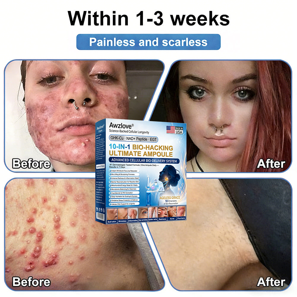 Official Store |Awzlove® GHK-Cu · NAD+ Peptide · EGT 10-in-1 Bio-Hacking Ultimate Ampoule | for Cellular Repair & Skin Longevity,From Acne & Redness to Deep Wrinkles & Laxity (Visible Results in 7 Days)
