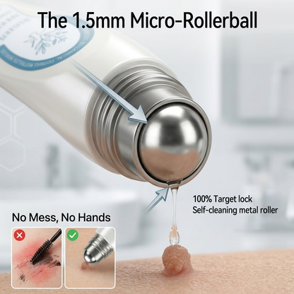 𝐇e𝐚𝐥𝐫i𝐳e® 7-𝐷𝑎𝑦 𝗧𝐚𝐠 & 𝗦𝗽𝐨𝐭 𝐄𝐫𝒂𝒔𝒆𝒓(Zero Pain, Zero 𝐒𝐜𝐚𝒓𝒔 Rollerball)💪