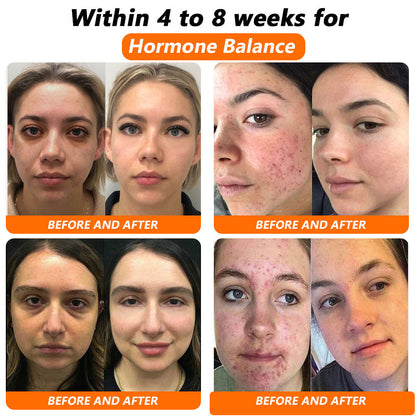 𝐂𝐯𝐫𝐞𝐨𝐳® 𝐁𝐞𝐞 𝐕𝐞𝐧𝐨𝐦 𝐍𝐌𝐍 𝐍𝐚𝐭𝐮𝐫𝐚𝐥 𝐑𝐞𝐩𝐚𝐢𝐫 𝐕𝐚𝐠𝐢𝐧𝐚𝐥 𝐂𝐚𝐩𝐬𝐮𝐥𝐞𝐬 [𝐅𝐨𝐫 𝐚𝐥𝐥 𝐯𝐚𝐠𝐢𝐧𝐚𝐥 𝐚𝐧𝐝 𝐡𝐨𝐫𝐦𝐨𝐧𝐚𝐥 𝐩𝐫𝐨𝐛𝐥𝐞𝐦𝐬]🌻