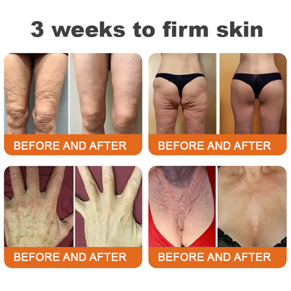 Awzlove® Luxurious Collagen & Stem Cell Anti-Cellulite Massage Oil🎉 (🔥70% Off for a Limited Time!) 💜