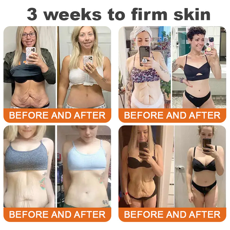 Awzlove® Luxurious Collagen & Stem Cell Anti-Cellulite Massage Oil🎉 (🔥70% Off for a Limited Time!) 💜