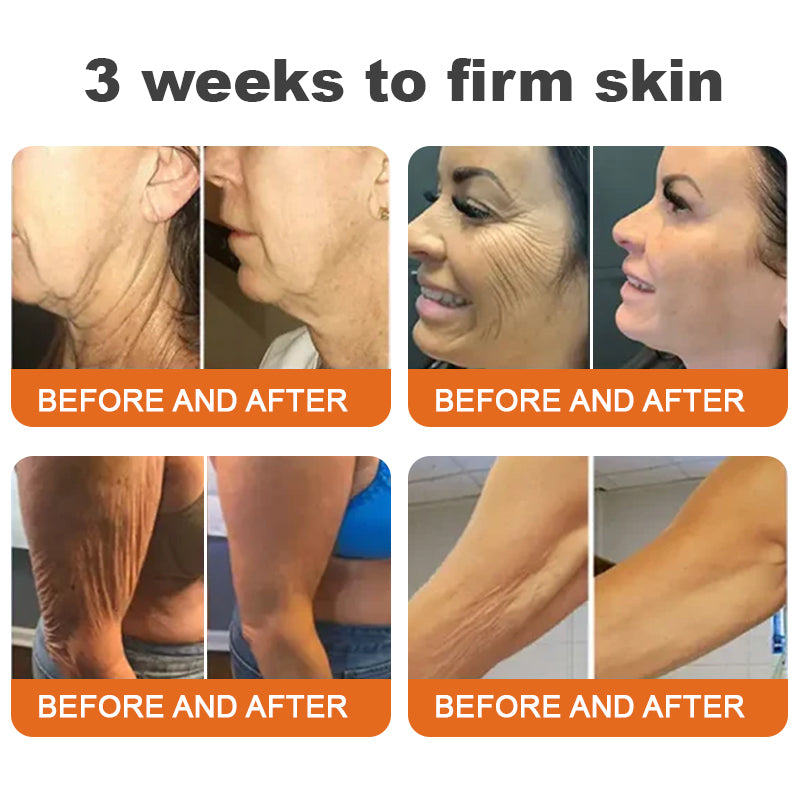 Awzlove® Luxurious Collagen & Stem Cell Anti-Cellulite Massage Oil🎉 (🔥70% Off for a Limited Time!) 💜