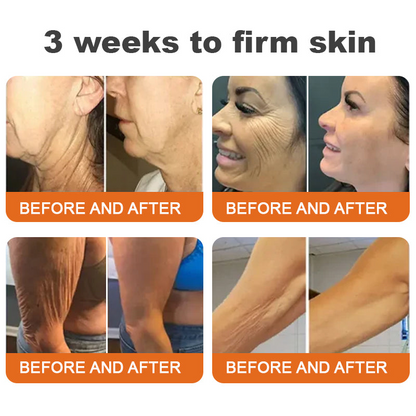 Awzlove® Luxurious Collagen & Stem Cell Anti-Cellulite Massage Oil🎉 (🔥70% Off for a Limited Time!) 💜